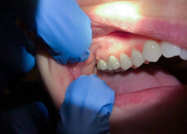 Best Emergency Broken Tooth Repair in Geneva, FL